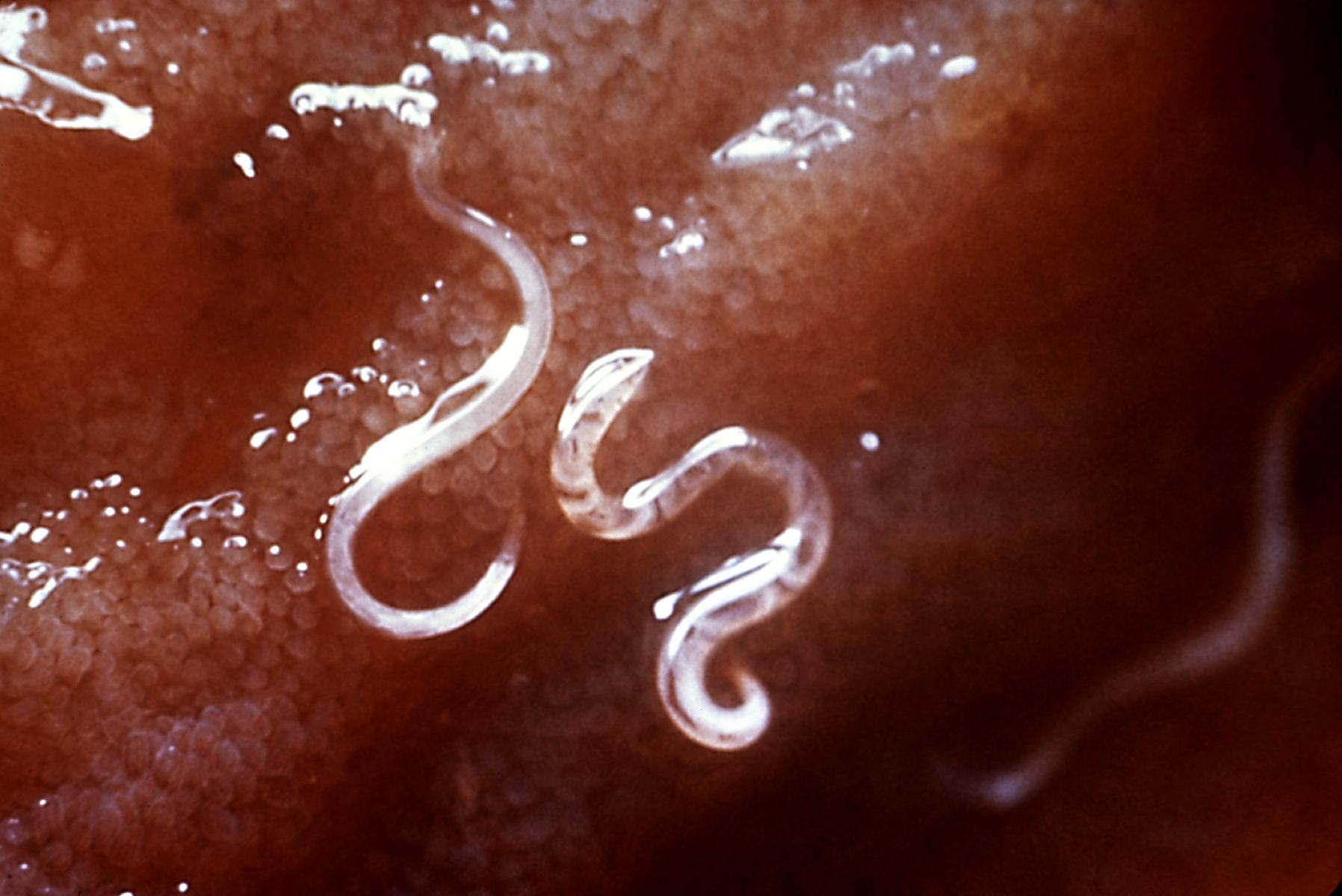 Ancylostoma caninum Intestine